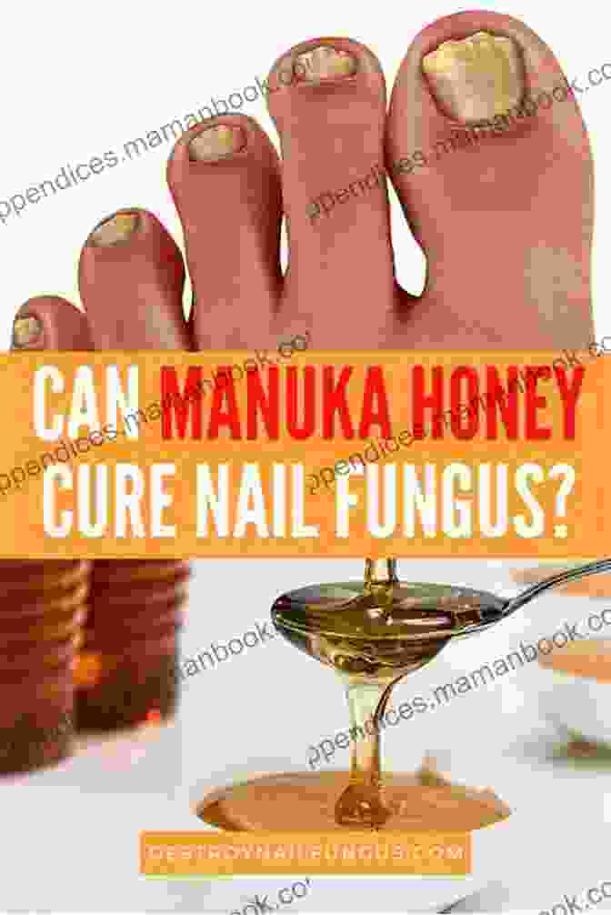 Honey Applied To Toenails For Antifungal Treatment 34 Uses For Honey (Natural Health 1)