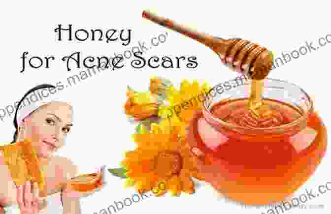 Honey Being Used To Treat Scars 34 Uses For Honey (Natural Health 1)